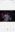 Screenshot_20210415_223130_com.android.gallery3d.jpg